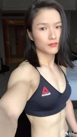 张伟丽
