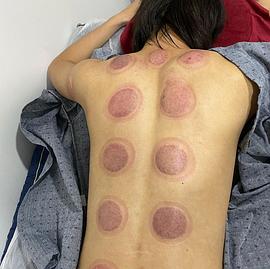 查诺崇·布恩玛纳翁