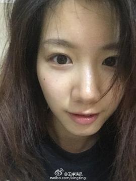 王婷