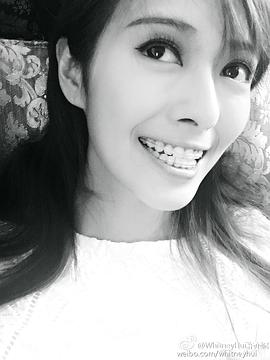 许亦妮